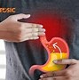 Loét Dạ Dày Trào Ngược Thực Quản